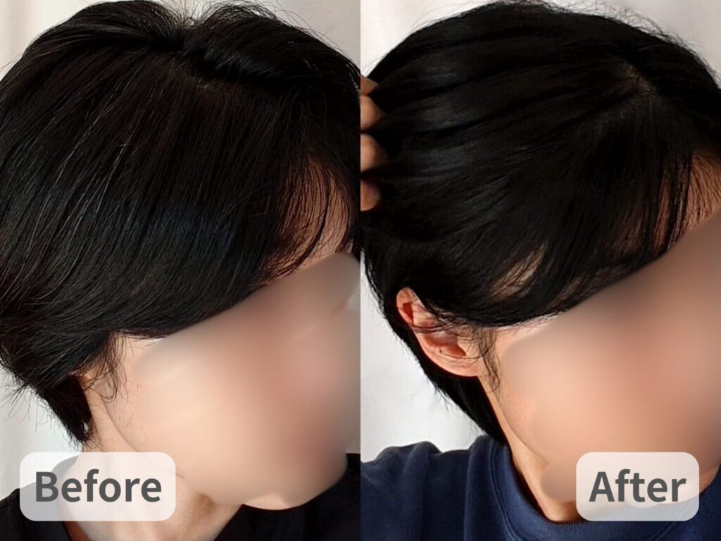 ヘナ+インディゴの染料で白髪を染める前と後を比較した写真。数本見えていた白髪が見えなくなっている。
